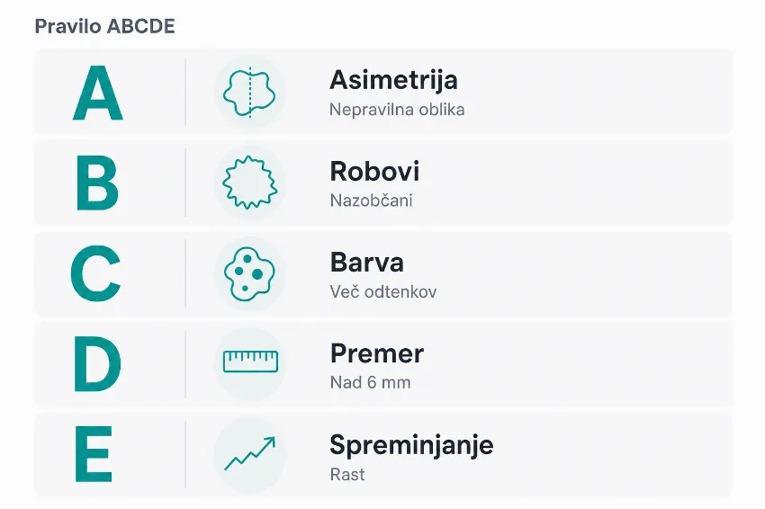 Infografika, ki prikazuje pravilo ABCDE za samopregledovanje kožnih znamenj s poudarkom na asimetriji, robovih, barvi, premeru in spreminjanju.